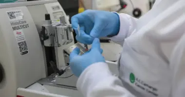 tratamento leucemia